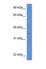 LIPA antibody LS-C135924 Western blot of HepG2 Cell lysate. Antibody concentration 1 ug/ml.