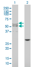 Western Blot analysis of LIPA expression in transfected 293T cell line by LIPA monoclonal antibody (M01), clone 1F9.Lane 1: LIPA transfected lysate(45 KDa).Lane 2: Non-transfected lysate.