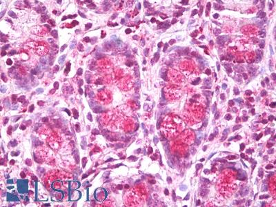 Anti-Lysosomal Acid Lipase / LAL antibody IHC of human small intestine. Immunohistochemistry of formalin-fixed, paraffin-embedded tissue after heat-induced antigen retrieval. Antibody LS-B7733 dilution 1:100.