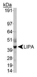 Lysosomal acid lipase Antibody - WB detection of LIPA in HepG2 whole cell extract.