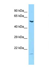 LIPC antibody LS-C146129 Western blot of Fetal Liver lysate. Antibody concentration 1 ug/ml.