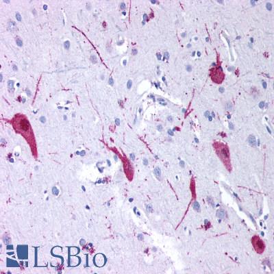 Anti-GRM4 / MGLUR4 antibody LS-A909 IHC of human brain, neurons and glia. Immunohistochemistry of formalin-fixed, paraffin-embedded tissue after heat-induced antigen retrieval.