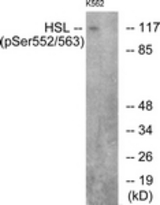 Western blot of extracts from K562 cells, using HSL (Phospho-Ser552) Antibody. The lane on the right was incubated with synthetic peptide.