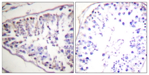 IHC of paraffin-embedded human tonsil tissue, using HSL (Ab-552) Antibody. The picture on the right is treated with the synthesized peptide.