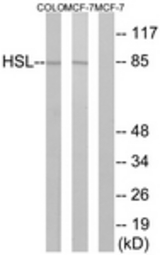 Western blot of extracts from COLO/MCF7 cells, using HSL (Ab-552) Antibody. The lane on the right is treated with the synthesized peptide.