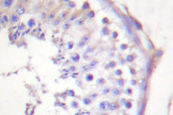 IHC of HSL (A546) pAb in paraffin-embedded human tonsil tissue.