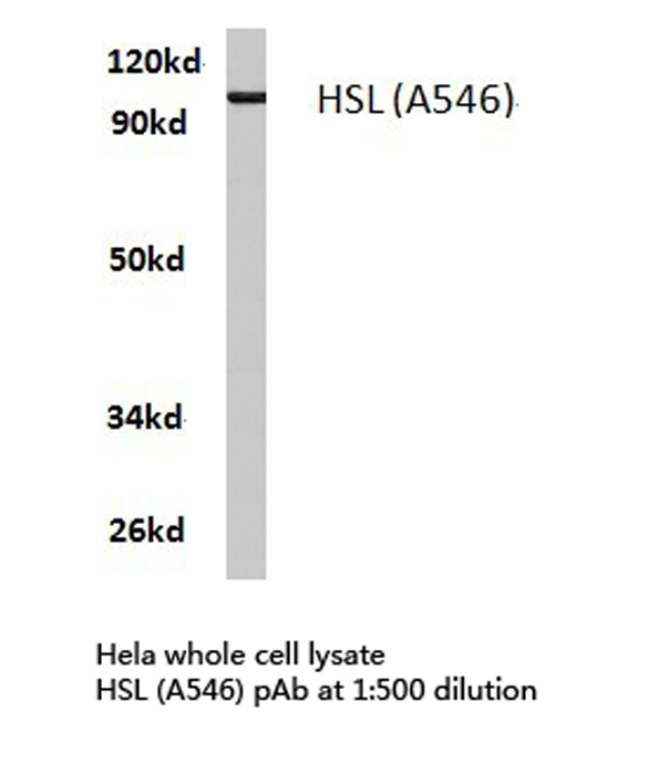 Western blot of HSL (A546) pAb in extracts from HeLa cells.