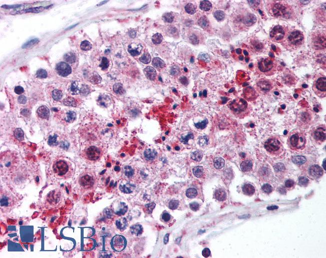 Anti-LIPE antibody IHC of human testis. Immunohistochemistry of formalin-fixed, paraffin-embedded tissue after heat-induced antigen retrieval. Antibody LS-B1374 concentration 5 ug/ml.