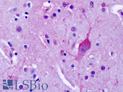 Anti-MGLUR4 antibody IHC of human brain, cortex, neurons. Immunohistochemistry of formalin-fixed, paraffin-embedded tissue after heat-induced antigen retrieval. Antibody LS-A4713 dilution 19 ug/ml.