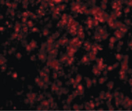 Immunofluorescence of Lipe in Human Lymph Node cells with Lipe antibody at 20 ug/ml.