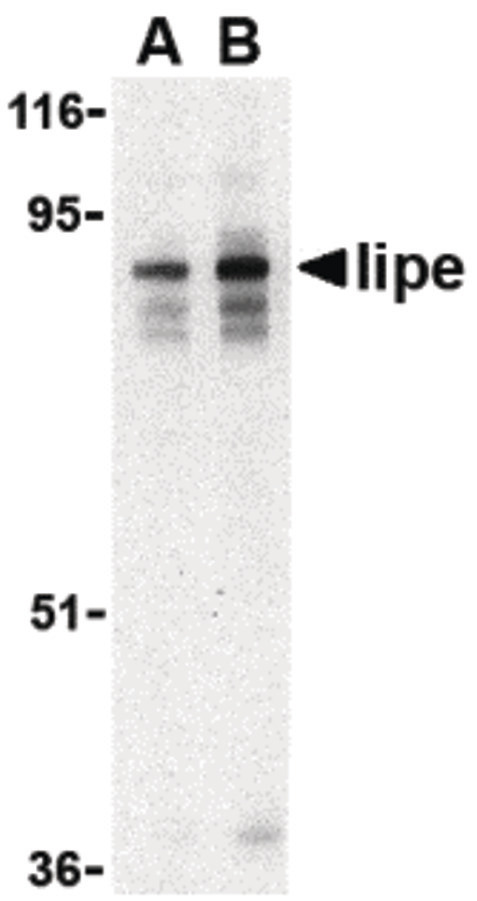 Western blot of lipe in human lymph node tissue lysate with lipe antibody at (A) 0.5 and (B) 1 ug/ml.