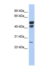 LIPF / Gastric Lipase antibody LS-C111173 Western blot of Fetal Stomach lysate.