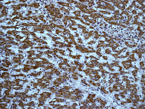 IHC of paraffin-embedded human liver tissue using anti-LIPF antibody.