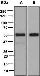 Western blot analysis on (A) human stomach and (B) mouse small intestine lysates using anti-LIPF antibody.