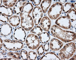 IHC of paraffin-embedded Kidney tissue using anti-LIPG mouse monoclonal antibody. (Dilution 1:50).