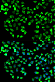 Immunofluorescence blot of MCF7 cell using GRM4 antibody. Blue: DAPI for nuclear staining.