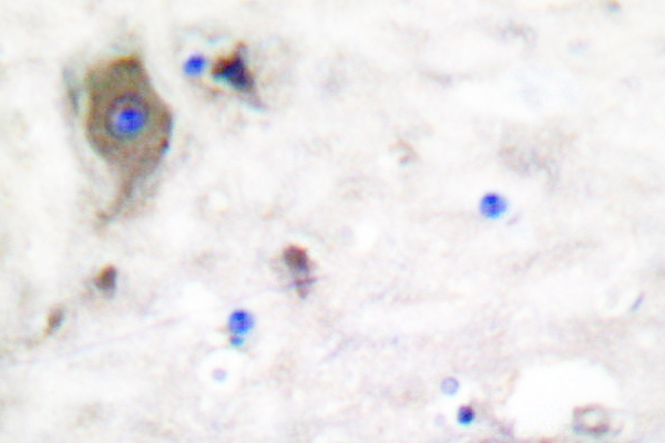IHC of mGLUR4 (Q875) pAb in paraffin-embedded human brain tissue.