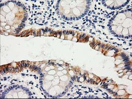 IHC of paraffin-embedded Human colon tissue using anti-LIPG mouse monoclonal antibody.