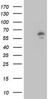 HEK293T cells were transfected with the pCMV6-ENTRY control (Left lane) or pCMV6-ENTRY LIPG (Right lane) cDNA for 48 hrs and lysed. Equivalent amounts of cell lysates (5 ug per lane) were separated by SDS-PAGE and immunoblotted with anti-LIPG.