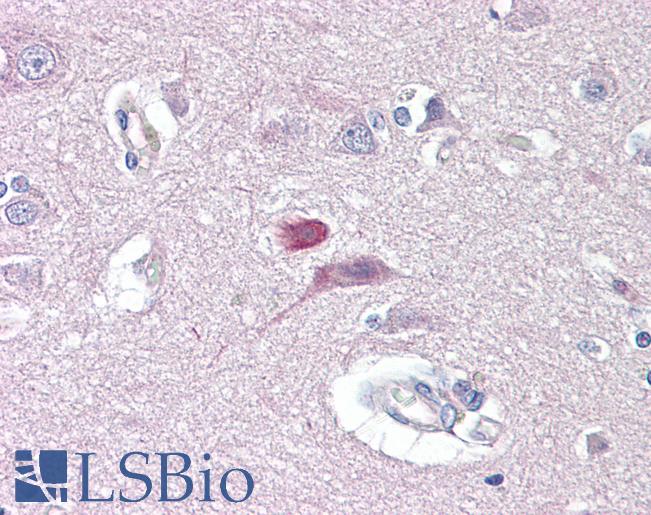 Anti-GRM4 / MGLUR4 antibody IHC of human brain, cortex. Immunohistochemistry of formalin-fixed, paraffin-embedded tissue after heat-induced antigen retrieval. Antibody LS-B7601 concentration 10 ug/ml.