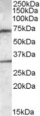 Antibody (0.3 ug/ml) staining of Human Liver lysate (35 ug protein in RIPA buffer). Primary incubation was 1 hour. Detected by chemiluminescence