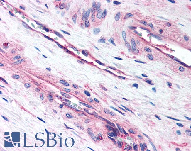 Anti-LIPG antibody IHC of human prostate, vessels. Immunohistochemistry of formalin-fixed, paraffin-embedded tissue after heat-induced antigen retrieval. Antibody LS-B168 concentration 10 ug/ml.