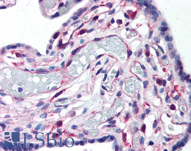 Anti-LIPG antibody IHC of human placenta. Immunohistochemistry of formalin-fixed, paraffin-embedded tissue after heat-induced antigen retrieval. Antibody LS-B167 concentration 10 ug/ml.