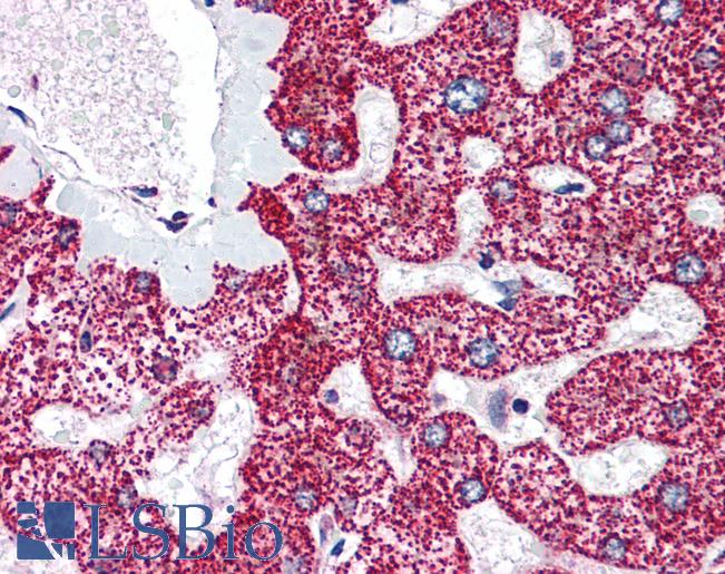 Anti-LIPG antibody IHC of human liver. Immunohistochemistry of formalin-fixed, paraffin-embedded tissue after heat-induced antigen retrieval. Antibody LS-B1599 concentration 5 ug/ml.