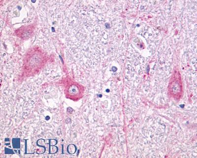 Anti-GRM5 / MGLUR5 antibody LS-A885 IHC of human brain, neurons and glia. Immunohistochemistry of formalin-fixed, paraffin-embedded tissue after heat-induced antigen retrieval.