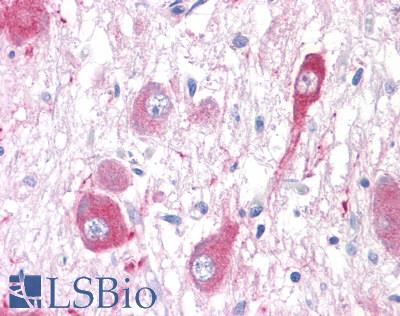 Anti-GRM5 / MGLUR5 antibody LS-A889 IHC of human brain, neurons and glia. Immunohistochemistry of formalin-fixed, paraffin-embedded tissue after heat-induced antigen retrieval.