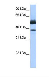 Fetal heart cell lysate. Antibody concentration: 0.5 ug/ml. Gel concentration: 12%.