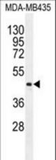 LIPK Antibody western blot of MDA-MB435 cell line lysates (35 ug/lane). The LIPK antibody detected the LIPK protein (arrow).