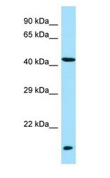 LIPM / LIPL3 antibody Western Blot of Fetal Liver.