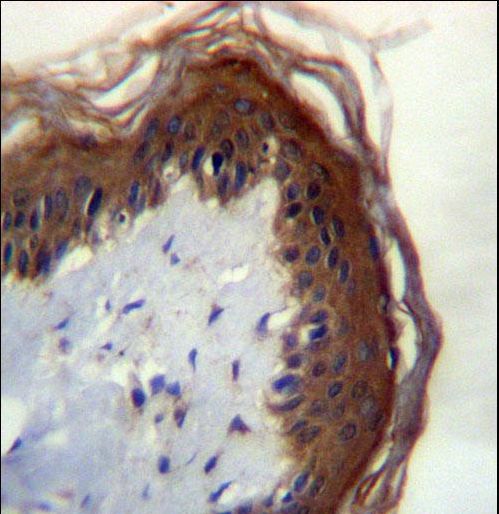 LIPM Antibody immunohistochemistry of formalin-fixed and paraffin-embedded human skin tissue followed by peroxidase-conjugated secondary antibody and DAB staining.