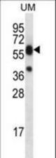 LIPM Antibody western blot of uterus tumor cell line lysates (35 ug/lane). The LIPM antibody detected the LIPM protein (arrow).