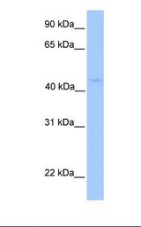 Hela cell lysate. Antibody concentration: 1.0 ug/ml. Gel concentration: 12%.