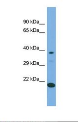 Western blot of Human 293T. LIPT2 antibody dilution 1.0 ug/ml.