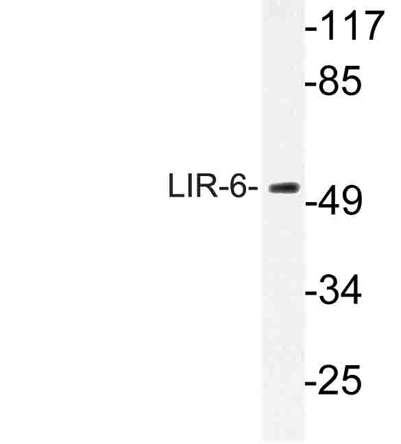 Western blot of LIR-6 (F83) pAb in extracts from MCF-7 cells.