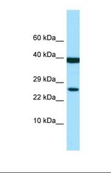 Western blot of Human MDA-MB-435S. LILRA1 antibody dilution 1.0 ug/ml.