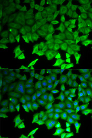 Immunofluorescence analysis of HeLa cell using LITAF antibody. Blue: DAPI for nuclear staining.