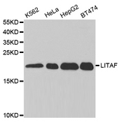 Western blot analysis of extracts of various cell lines, using LITAF antibody.