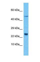 Western blot of LITAF Antibody with human 786-0 Whole Cell lysate.