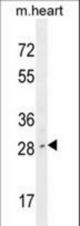 LIX1 Antibody western blot of mouse heart tissue lysates (35 ug/lane). The LIX1 antibody detected the LIX1 protein (arrow).