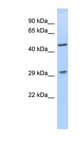 LIX1 antibody LS-C111486 Western blot of Jurkat lysate.