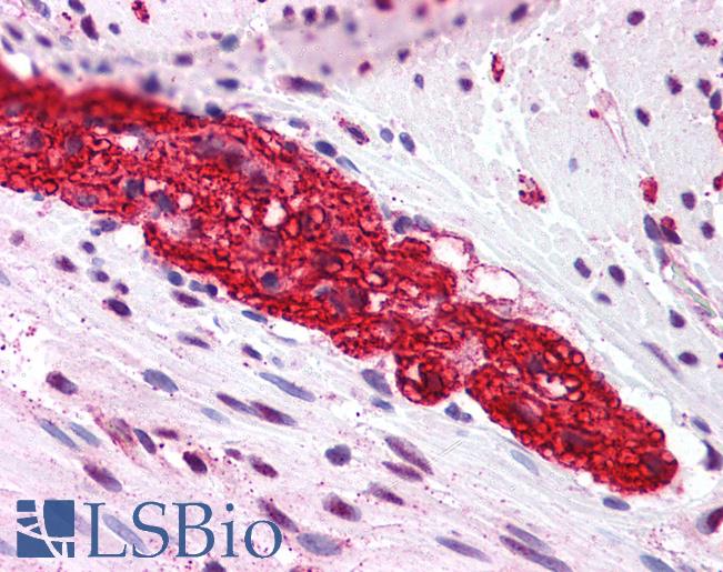 Anti-GRM5 / MGLUR5 antibody LS-A883 IHC of human colon, myenteric plexus. Immunohistochemistry of formalin-fixed, paraffin-embedded tissue after heat-induced antigen retrieval.