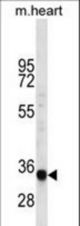 LIX1L Antibody western blot of mouse heart tissue lysates (35 ug/lane). The LIX1L antibody detected the LIX1L protein (arrow).