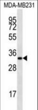 LIX1L Antibody western blot of MDA-MB231 cell line lysates (35 ug/lane). The LIX1L antibody detected the LIX1L protein (arrow).