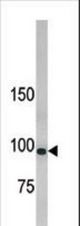Western blot of anti-hLLGL1 antibody in 293 cell line lysate. hLLGL1(arrow) was detected using the purified antibody.