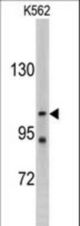 Western blot of LLGL2 antibody in K562 cell line lysates (35 ug/lane). LLGL2 (arrow) was detected using the purified antibody.