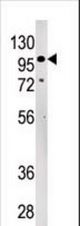 Western blot of anti-LLGL2 Pabin 293 cell line lysate (35 ug/lane). LLGL2(arrow) was detected using the purified antibody.